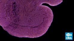 ORA Purple Capricornis Coral